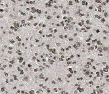 HNRNPC Antibody
