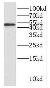 HNRNPH1 Rabbit Polyclonal Antibody