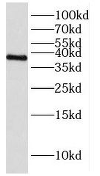 HNRNPH3 Antibody