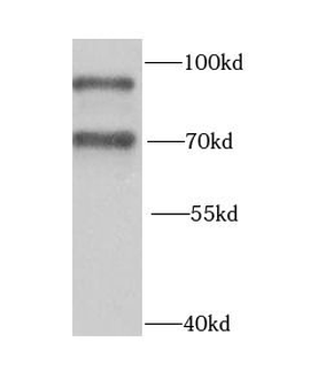 HNRNPR Rabbit Polyclonal Antibody