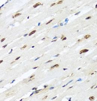 HNRNPR Rabbit Polyclonal Antibody