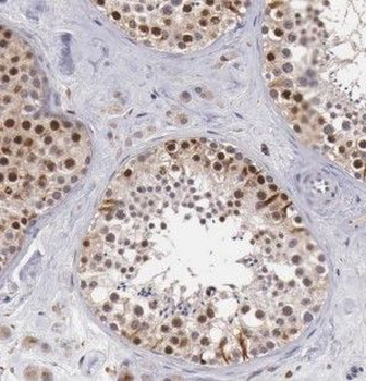 HOMEZ Rabbit Polyclonal Antibody