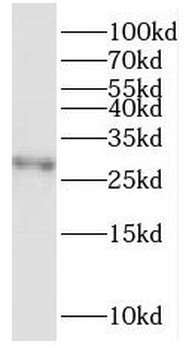 HOXD4 Rabbit Polyclonal Antibody