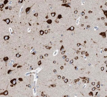 HPRT1 Rabbit Polyclonal Antibody