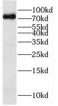 HPS1 Rabbit Polyclonal Antibody