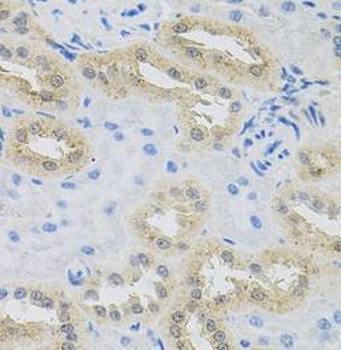 HPS1 Rabbit Polyclonal Antibody