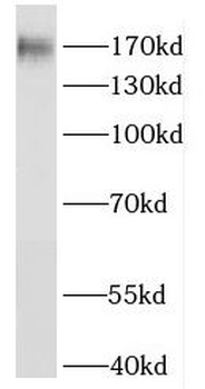 HRC Rabbit Polyclonal Antibody