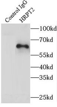 CDC73 Antibody
