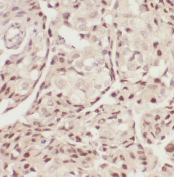 CDC73 Antibody