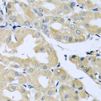 HS1BP3 Rabbit Polyclonal Antibody