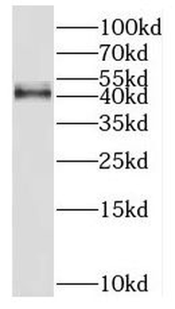 HSD11B2 Rabbit Polyclonal Antibody