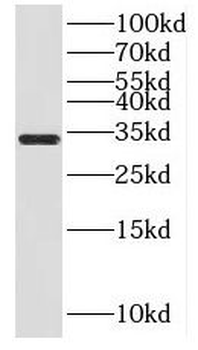 HSD17B11 Rabbit Polyclonal Antibody