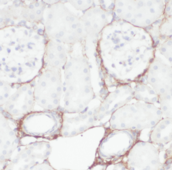 HSD17B11 Rabbit Polyclonal Antibody