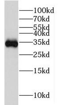 HSD17B11 Rabbit Polyclonal Antibody