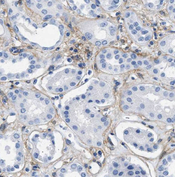 HSD17B11 Rabbit Polyclonal Antibody