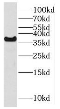 HSD17B2 Rabbit Polyclonal Antibody