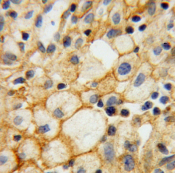 HSD17B2 Rabbit Polyclonal Antibody