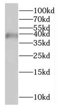 HSDL1 Rabbit Polyclonal Antibody