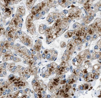 HSDL1 Rabbit Polyclonal Antibody