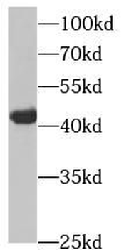 HSDL2 Rabbit Polyclonal Antibody