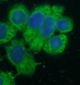 HSDL2 Rabbit Polyclonal Antibody