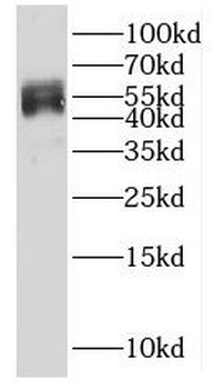 HSF4 Rabbit Polyclonal Antibody