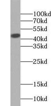 HSFY1 Rabbit Polyclonal Antibody