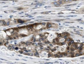 HSP90AB1 Rabbit Polyclonal Antibody
