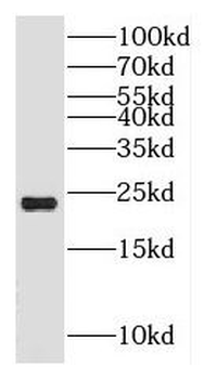 HSPB7 Rabbit Polyclonal Antibody