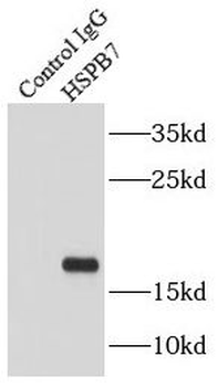 HSPB7 Rabbit Polyclonal Antibody