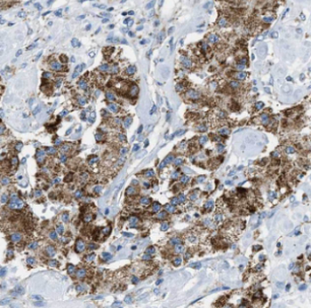 HSPB7 Rabbit Polyclonal Antibody