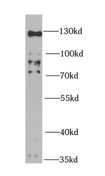 HTATSF1 Rabbit Polyclonal Antibody