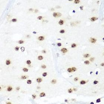 HTATSF1 Rabbit Polyclonal Antibody
