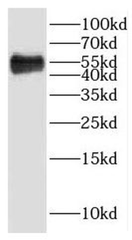 HTRA4 Rabbit Polyclonal Antibody