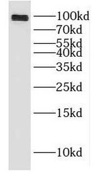 DLGAP5 Antibody
