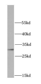 HUS1 Rabbit Polyclonal Antibody