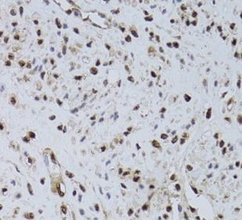 HUS1 Rabbit Polyclonal Antibody