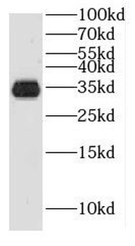 HUS1B Rabbit Polyclonal Antibody