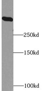 HUWE1 Rabbit Polyclonal Antibody