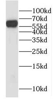 HYAL2 Rabbit Polyclonal Antibody