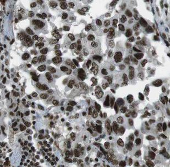HYAL2 Rabbit Polyclonal Antibody