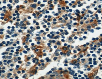AIF1 Antibody