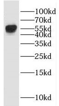 ICA1L Rabbit Polyclonal Antibody