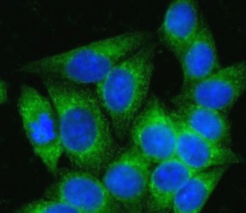 ICA1L Rabbit Polyclonal Antibody