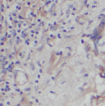 ICAM2 Rabbit Polyclonal Antibody