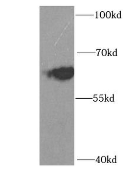 ID3 Rabbit Polyclonal Antibody