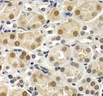 ID3 Rabbit Polyclonal Antibody