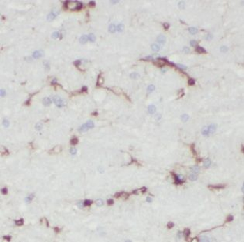 IDH3G Rabbit Polyclonal Antibody