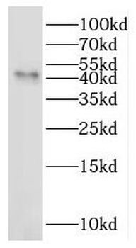 IDO2 Rabbit Polyclonal Antibody