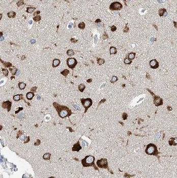 IFFO1 Rabbit Polyclonal Antibody